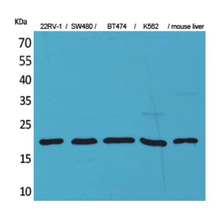 Western blot - VEGF-A Polyclonal Antibody from Signalway Antibody (41552) - Antibodies.com