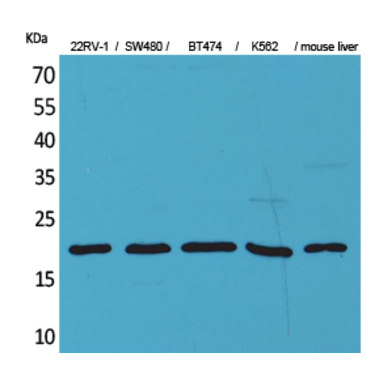 Western blot - VEGF-A Polyclonal Antibody from Signalway Antibody (41552) - Antibodies.com