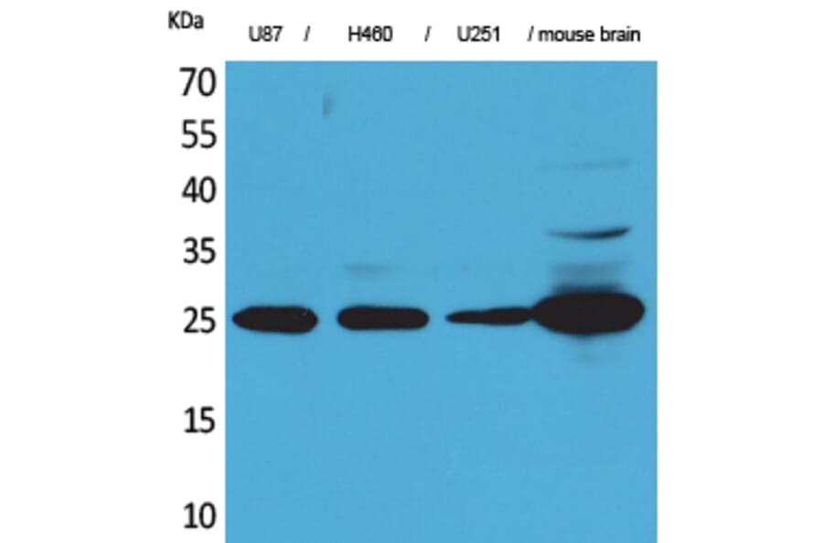 Western blot - UCH-L1 Polyclonal Antibody from Signalway Antibody (41556) - Antibodies.com