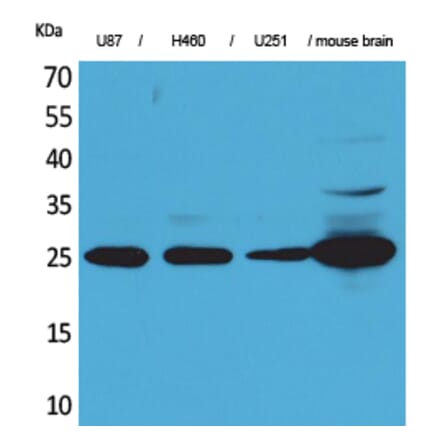 Western blot - UCH-L1 Polyclonal Antibody from Signalway Antibody (41556) - Antibodies.com