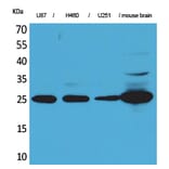 Western blot - UCH-L1 Polyclonal Antibody from Signalway Antibody (41556) - Antibodies.com