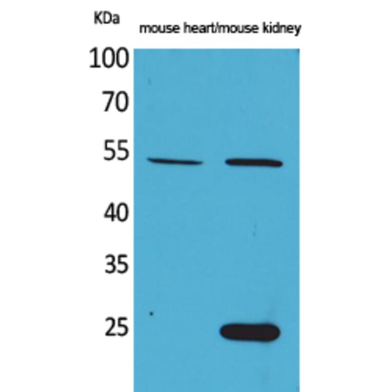 Western blot - Sg III Polyclonal Antibody from Signalway Antibody (41557) - Antibodies.com