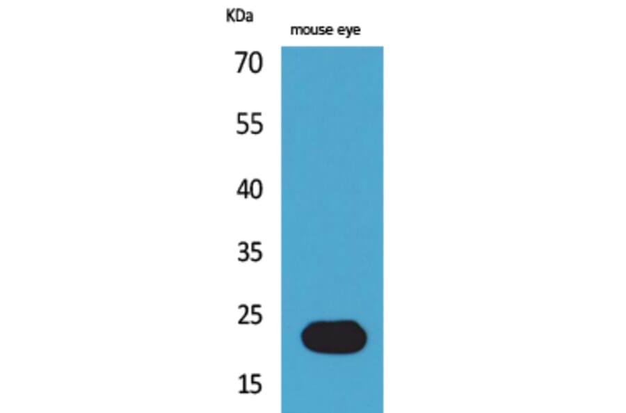 Western blot - BNIP-3 Polyclonal Antibody from Signalway Antibody (41567) - Antibodies.com