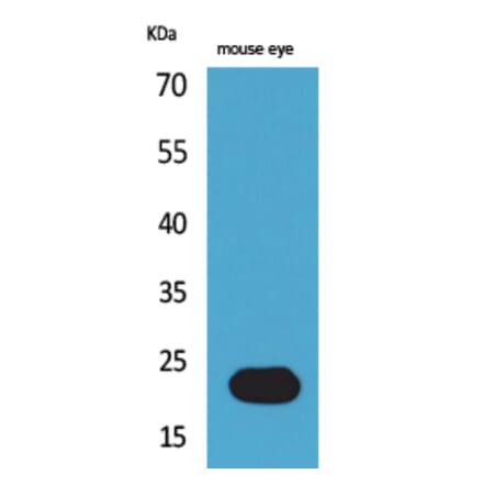 Western blot - BNIP-3 Polyclonal Antibody from Signalway Antibody (41567) - Antibodies.com
