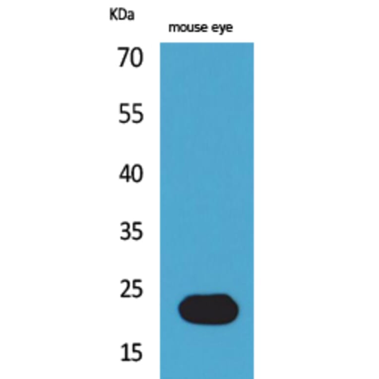 Western blot - BNIP-3 Polyclonal Antibody from Signalway Antibody (41567) - Antibodies.com