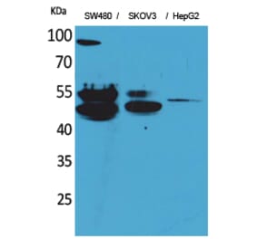 Western blot - c-FLIP Polyclonal Antibody from Signalway Antibody (41569) - Antibodies.com