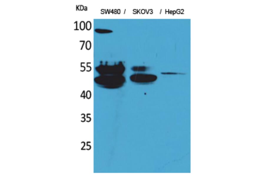 Western blot - c-FLIP Polyclonal Antibody from Signalway Antibody (41569) - Antibodies.com