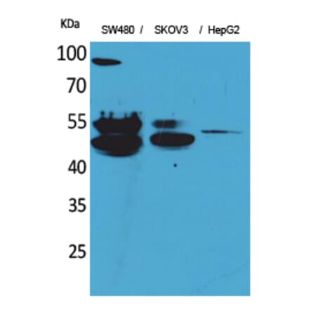 Western blot - c-FLIP Polyclonal Antibody from Signalway Antibody (41569) - Antibodies.com