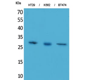 Western blot - BRMS-1 Polyclonal Antibody from Signalway Antibody (41571) - Antibodies.com