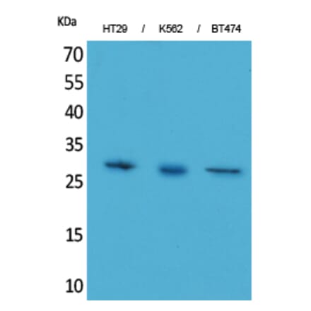 Western blot - BRMS-1 Polyclonal Antibody from Signalway Antibody (41571) - Antibodies.com
