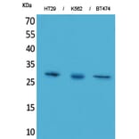 Western blot - BRMS-1 Polyclonal Antibody from Signalway Antibody (41571) - Antibodies.com