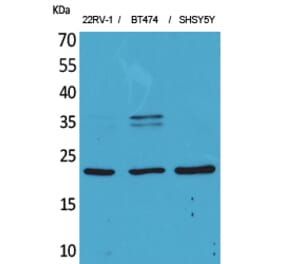Western blot - FGF-12 Polyclonal Antibody from Signalway Antibody (41572) - Antibodies.com