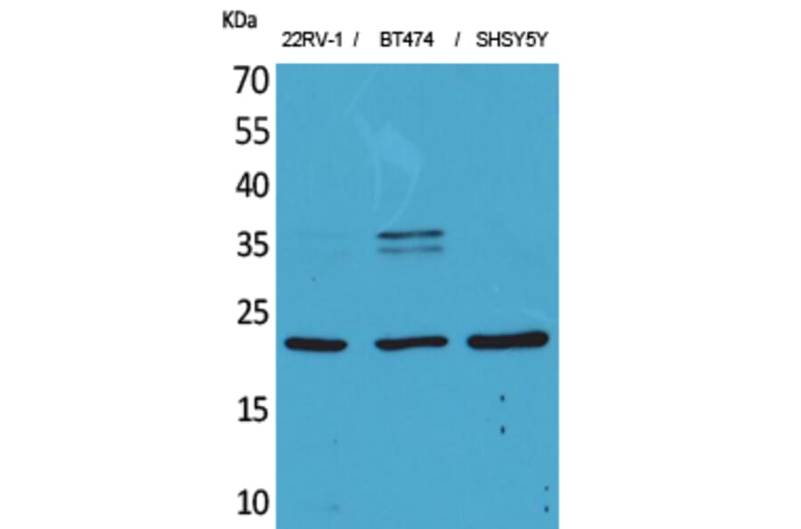 Western blot - FGF-12 Polyclonal Antibody from Signalway Antibody (41572) - Antibodies.com