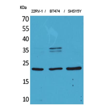 Western blot - FGF-12 Polyclonal Antibody from Signalway Antibody (41572) - Antibodies.com