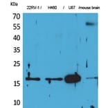 Western blot - Apelin Polyclonal Antibody from Signalway Antibody (41574) - Antibodies.com
