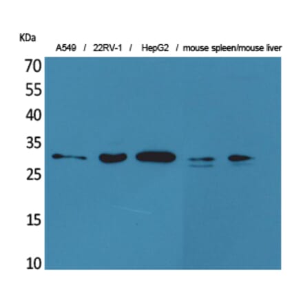 Western blot - TALL-1 Polyclonal Antibody from Signalway Antibody (41577) - Antibodies.com