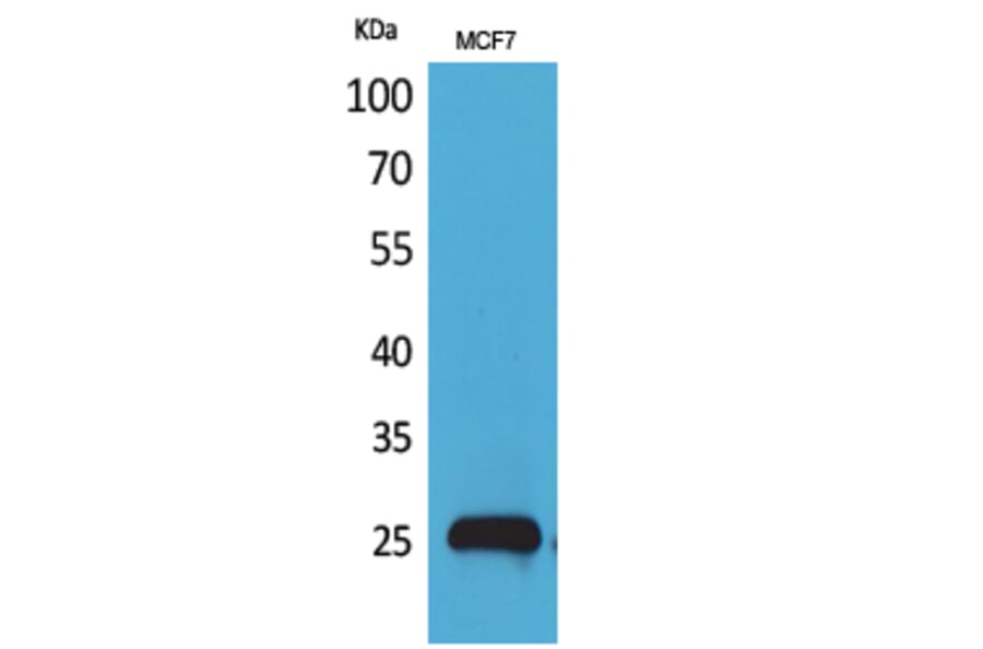 Western blot - CBP 35 Polyclonal Antibody from Signalway Antibody (41579) - Antibodies.com
