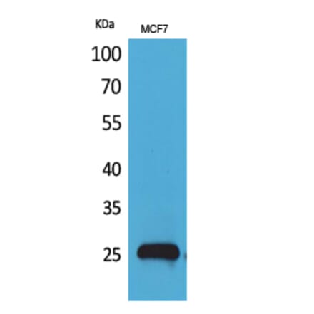 Western blot - CBP 35 Polyclonal Antibody from Signalway Antibody (41579) - Antibodies.com