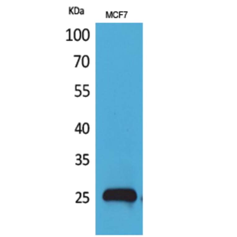 Western blot - CBP 35 Polyclonal Antibody from Signalway Antibody (41579) - Antibodies.com