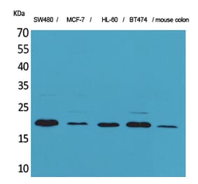 Western blot - FGF-20 Polyclonal Antibody from Signalway Antibody (41587) - Antibodies.com