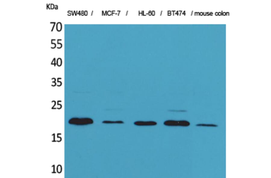Western blot - FGF-20 Polyclonal Antibody from Signalway Antibody (41587) - Antibodies.com