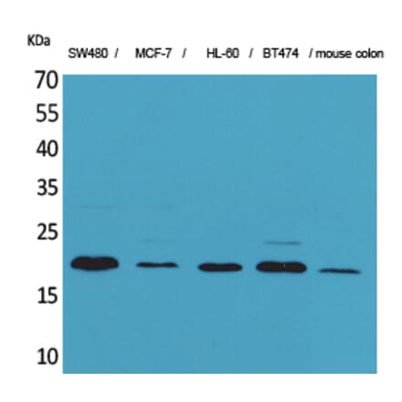 Western blot - FGF-20 Polyclonal Antibody from Signalway Antibody (41587) - Antibodies.com