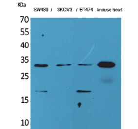 Western blot - FGF-18 Polyclonal Antibody from Signalway Antibody (41590) - Antibodies.com