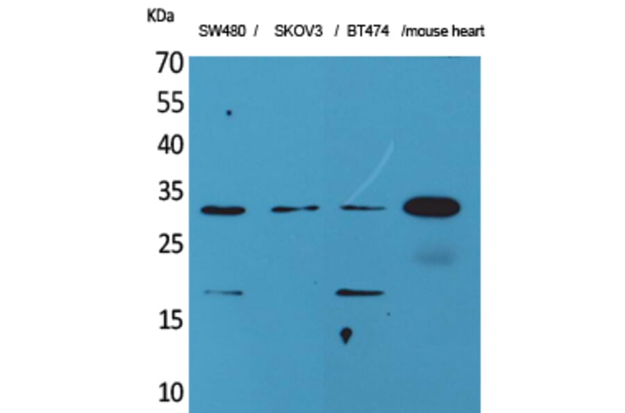 Western blot - FGF-18 Polyclonal Antibody from Signalway Antibody (41590) - Antibodies.com