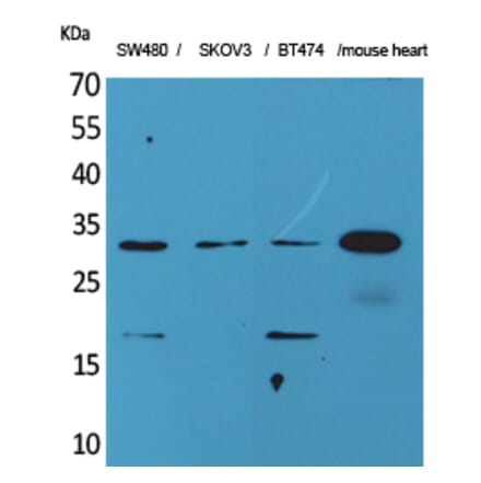 Western blot - FGF-18 Polyclonal Antibody from Signalway Antibody (41590) - Antibodies.com