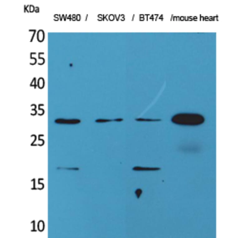 Western blot - FGF-18 Polyclonal Antibody from Signalway Antibody (41590) - Antibodies.com