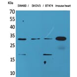 Western blot - FGF-18 Polyclonal Antibody from Signalway Antibody (41590) - Antibodies.com