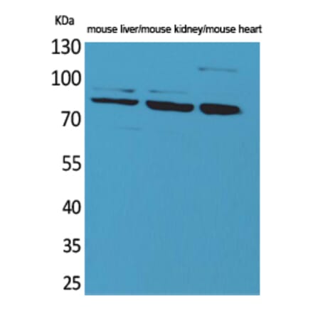 Western blot - CUL-4B Polyclonal Antibody from Signalway Antibody (41597) - Antibodies.com