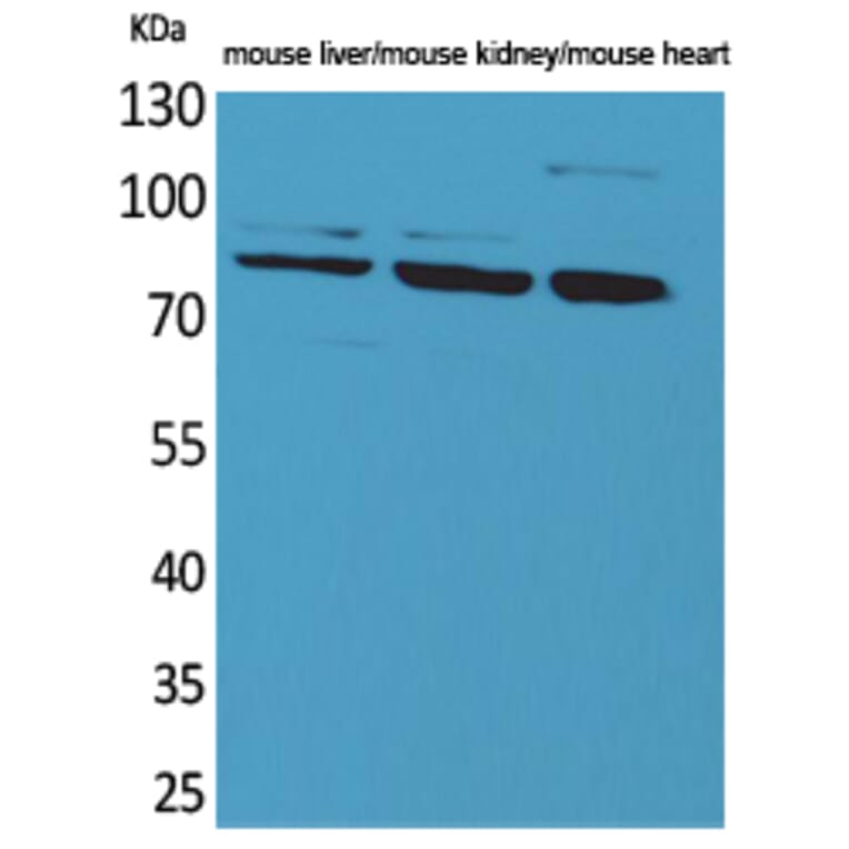 Western blot - CUL-4B Polyclonal Antibody from Signalway Antibody (41597) - Antibodies.com