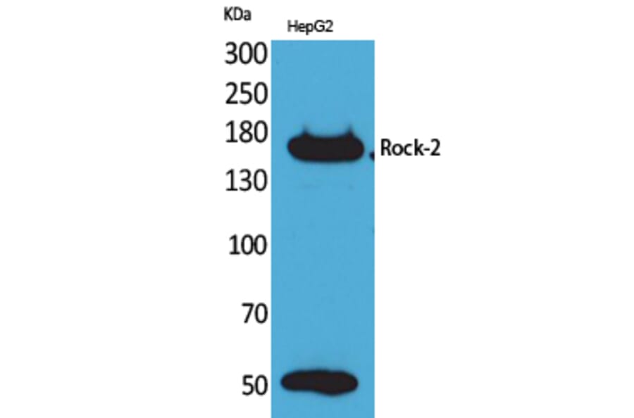 Western blot - Rock-2 Polyclonal Antibody from Signalway Antibody (41602) - Antibodies.com