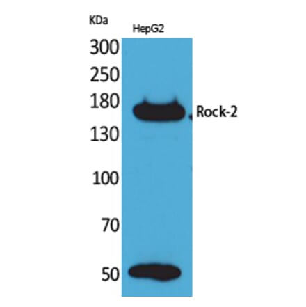 Western blot - Rock-2 Polyclonal Antibody from Signalway Antibody (41602) - Antibodies.com