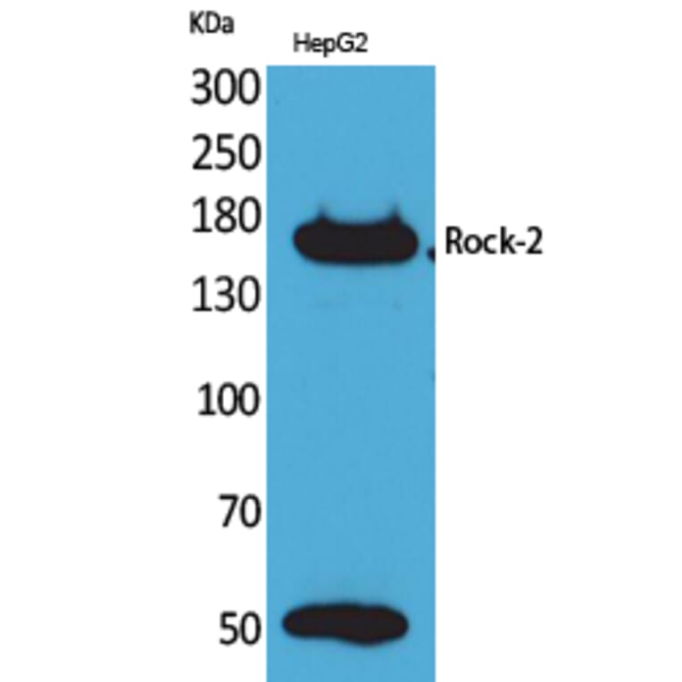 Western blot - Rock-2 Polyclonal Antibody from Signalway Antibody (41602) - Antibodies.com
