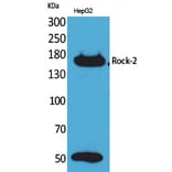 Western blot - Rock-2 Polyclonal Antibody from Signalway Antibody (41602) - Antibodies.com