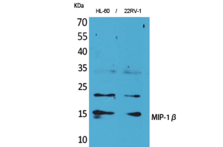 Western blot - MIP-1β Polyclonal Antibody from Signalway Antibody (41616) - Antibodies.com