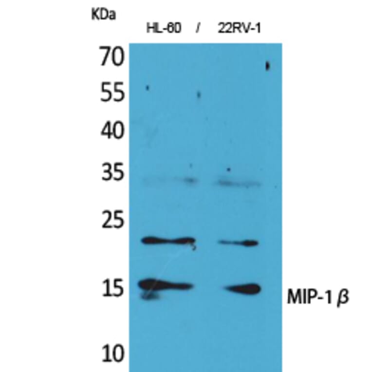 Western blot - MIP-1β Polyclonal Antibody from Signalway Antibody (41616) - Antibodies.com