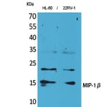 Western blot - MIP-1β Polyclonal Antibody from Signalway Antibody (41616) - Antibodies.com