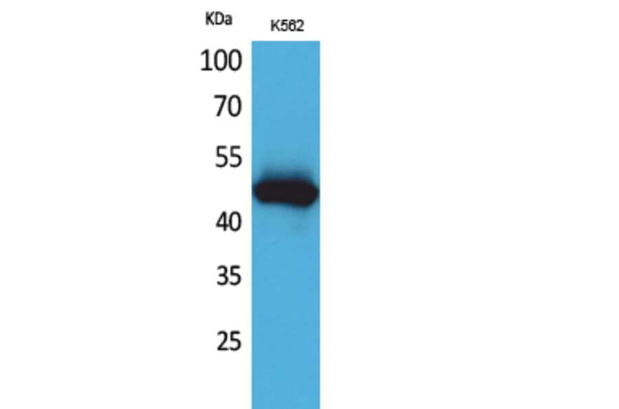 Western blot - IL-5Rα Polyclonal Antibody from Signalway Antibody (41622) - Antibodies.com