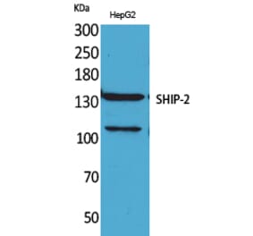 Western blot - SHIP-2 Polyclonal Antibody from Signalway Antibody (41634) - Antibodies.com