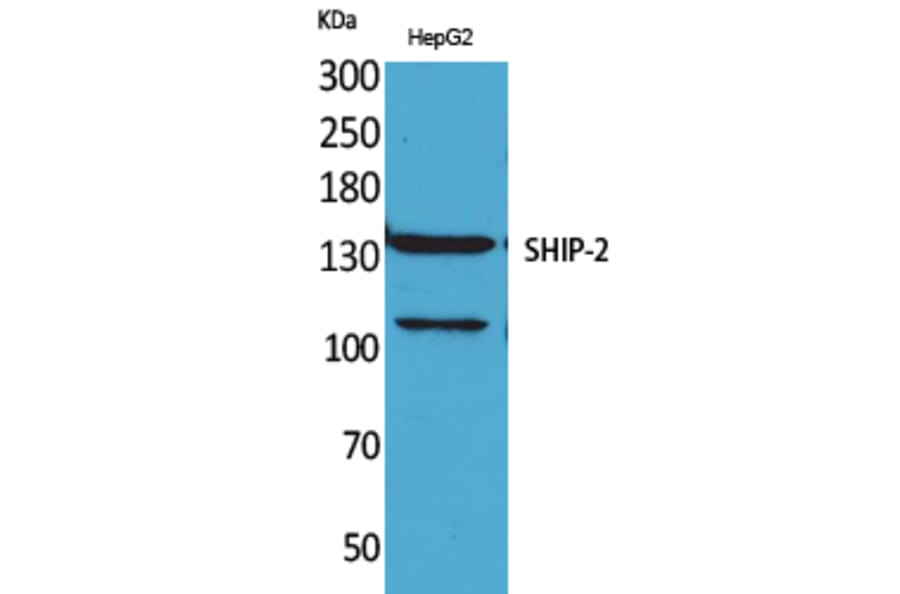 Western blot - SHIP-2 Polyclonal Antibody from Signalway Antibody (41634) - Antibodies.com