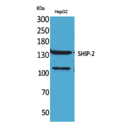 Western blot - SHIP-2 Polyclonal Antibody from Signalway Antibody (41634) - Antibodies.com