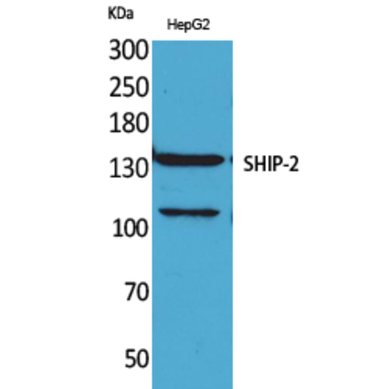 Western blot - SHIP-2 Polyclonal Antibody from Signalway Antibody (41634) - Antibodies.com