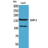 Western blot - SHIP-2 Polyclonal Antibody from Signalway Antibody (41634) - Antibodies.com