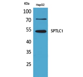 Western blot - SPTLC1 Polyclonal Antibody from Signalway Antibody (41640) - Antibodies.com