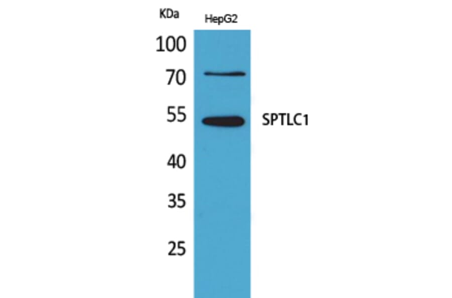Western blot - SPTLC1 Polyclonal Antibody from Signalway Antibody (41640) - Antibodies.com