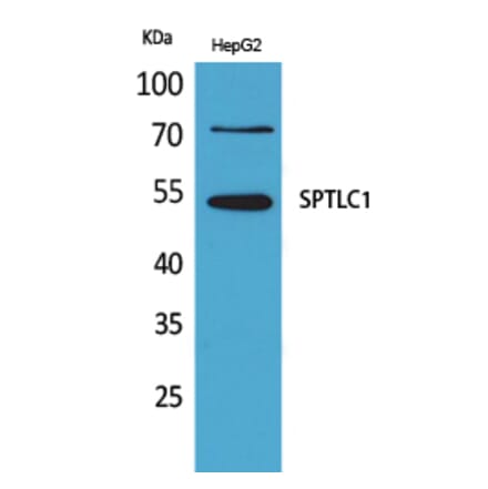 Western blot - SPTLC1 Polyclonal Antibody from Signalway Antibody (41640) - Antibodies.com