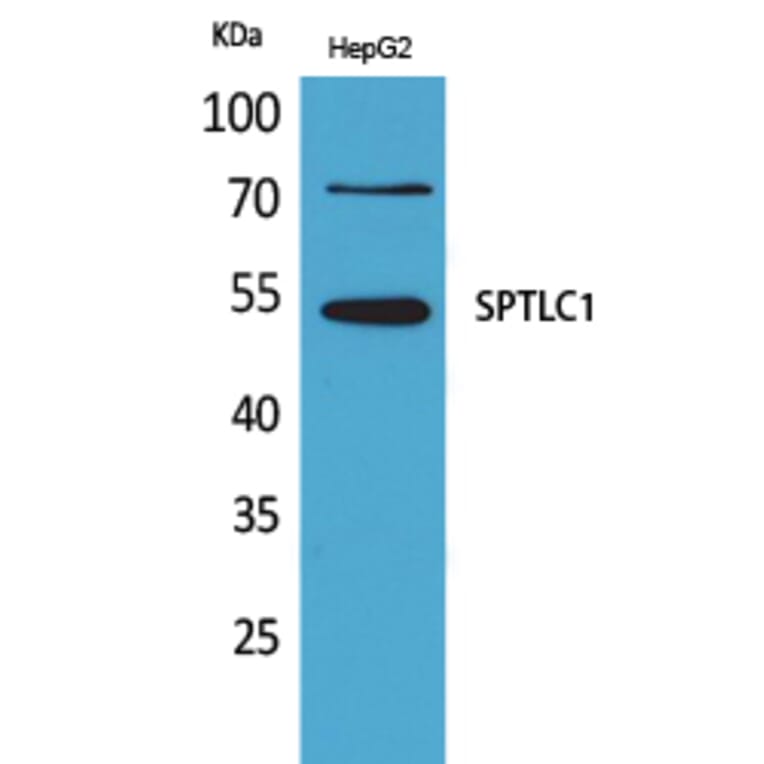 Western blot - SPTLC1 Polyclonal Antibody from Signalway Antibody (41640) - Antibodies.com